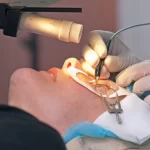 عوارض و خطرات عمل فمتولیزیک - دکتر نرگس حسنلو