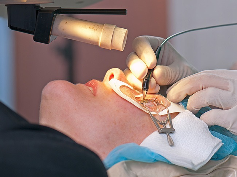 عوارض و خطرات عمل فمتولیزیک - دکتر نرگس حسنلو