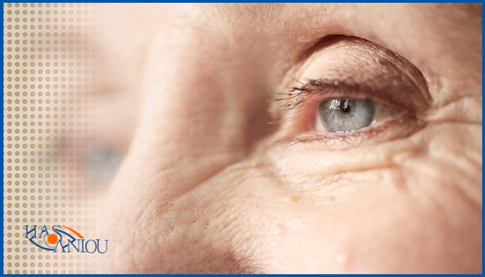هزینه عمل آب سیاه شامل چه مواردی است؟