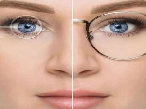 هزینه عمل فمتولیزیک چشم در سال 1403 - دکتر نرگس حسنلو