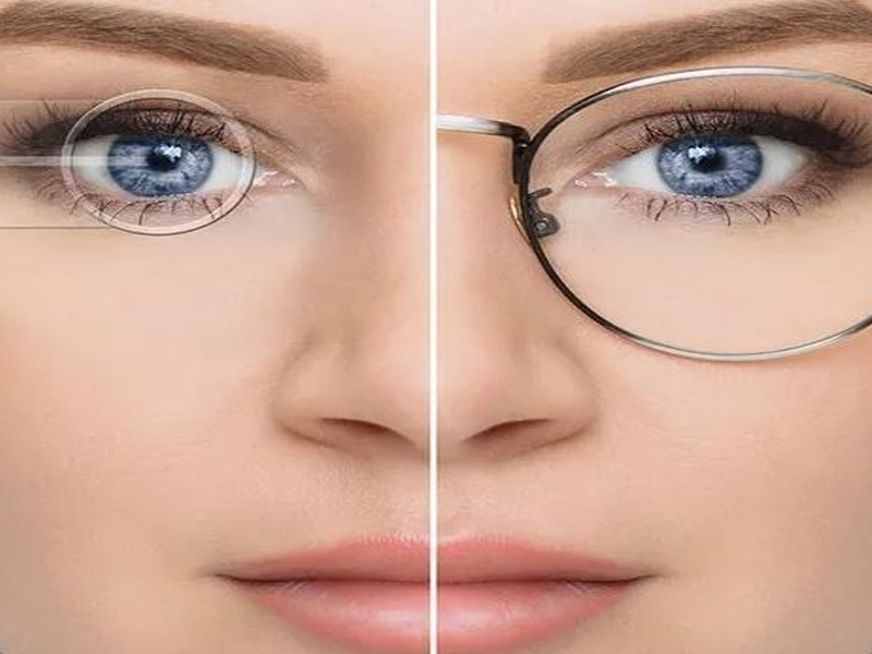 هزینه عمل فمتولیزیک چشم در سال 1403 - دکتر نرگس حسنلو
