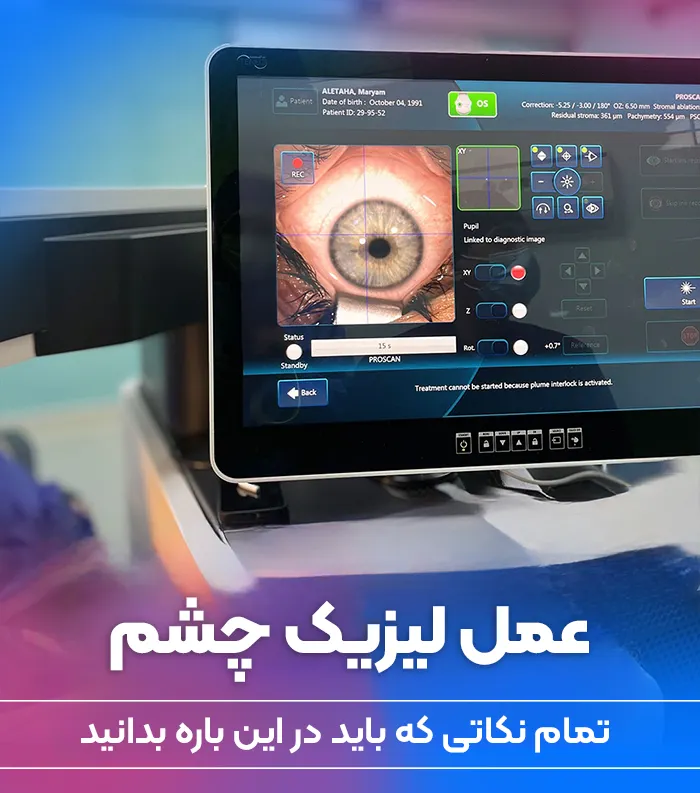 عمل لیزیک
