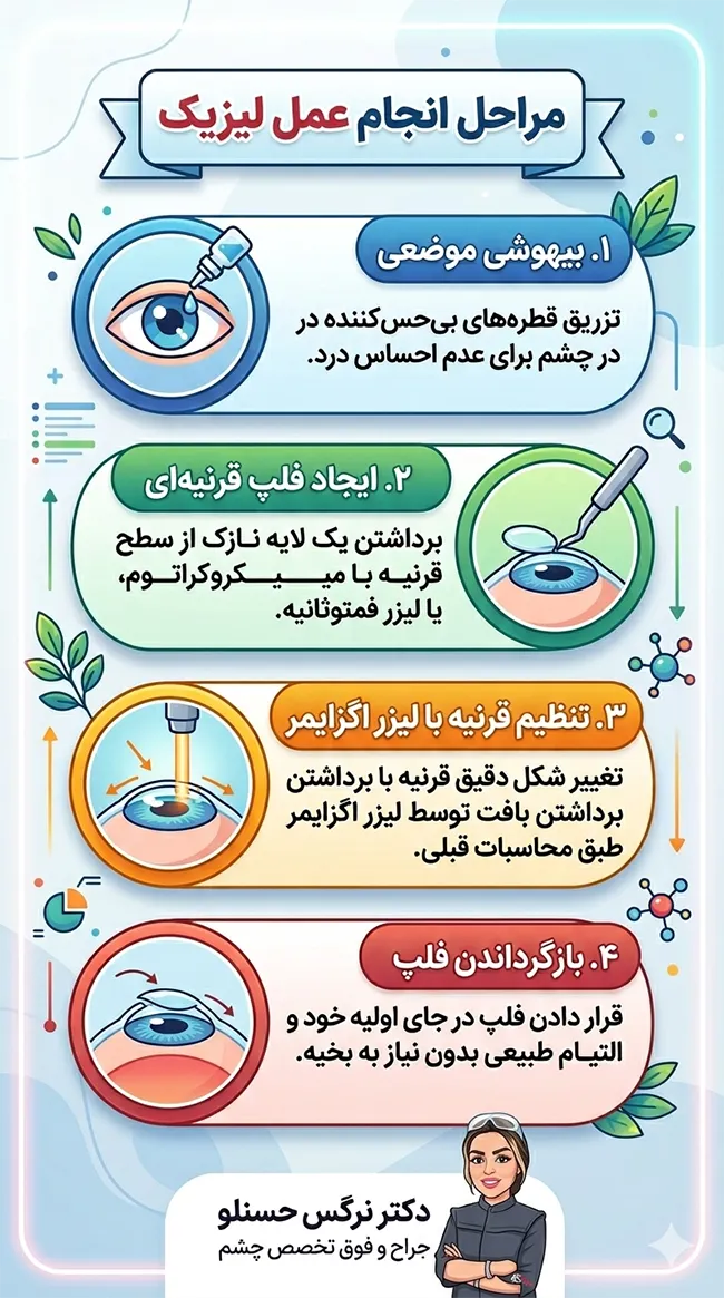 مراحل انجام عمل لیزیک