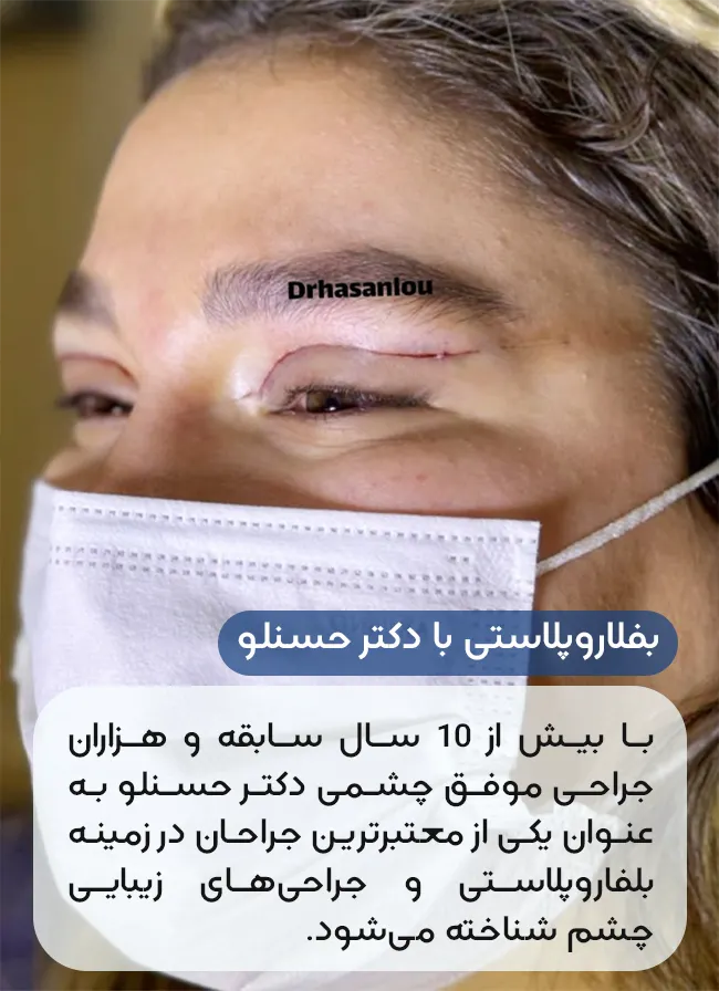 بلفارو با دکتر نرگس حسنلو