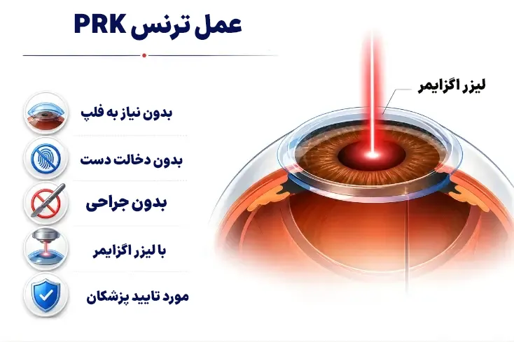 عمل ترنس PRK